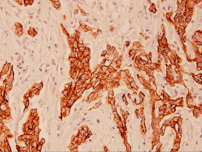 Cytokeratin 8 Antibody in Immunohistochemistry (Paraffin) (IHC (P))