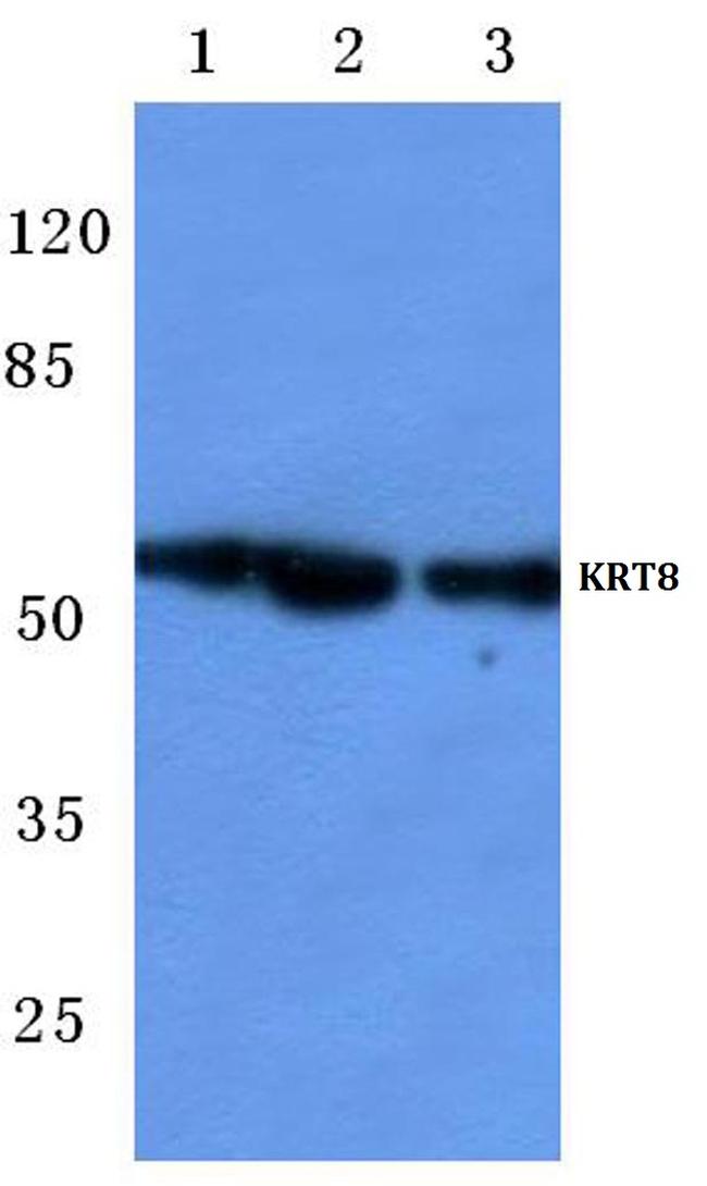 Cytokeratin 8 Antibody in Western Blot (WB)