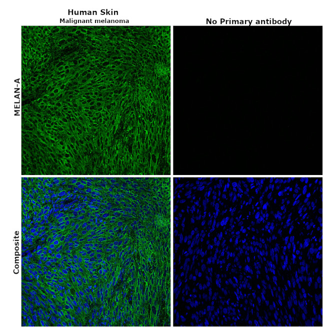 Melan-A Antibody in Immunohistochemistry (Paraffin) (IHC (P))