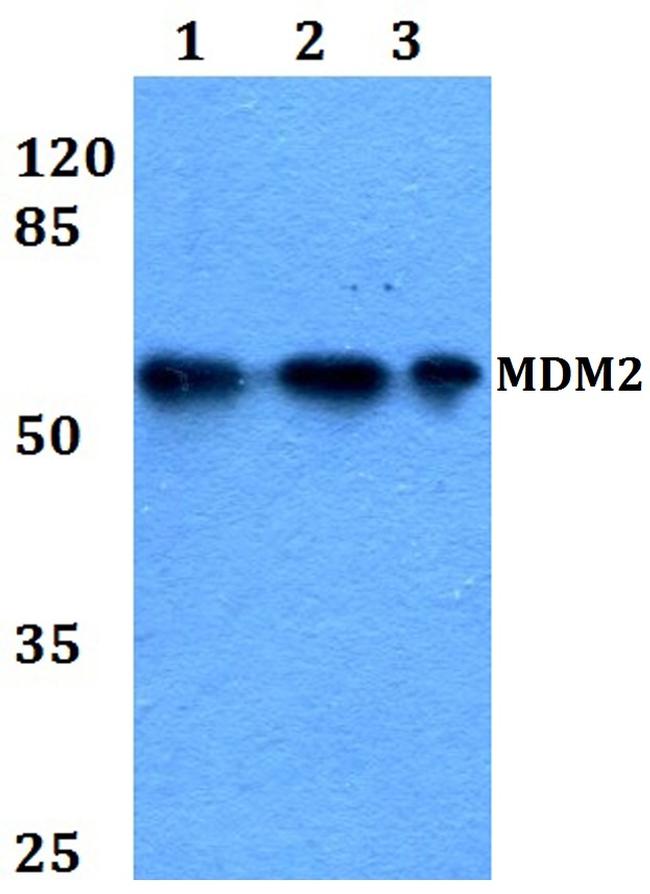 MDM2 Antibody in Western Blot (WB)