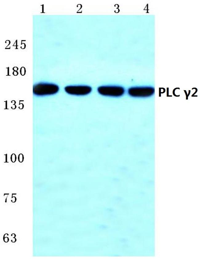 PLCG2 Antibody in Western Blot (WB)