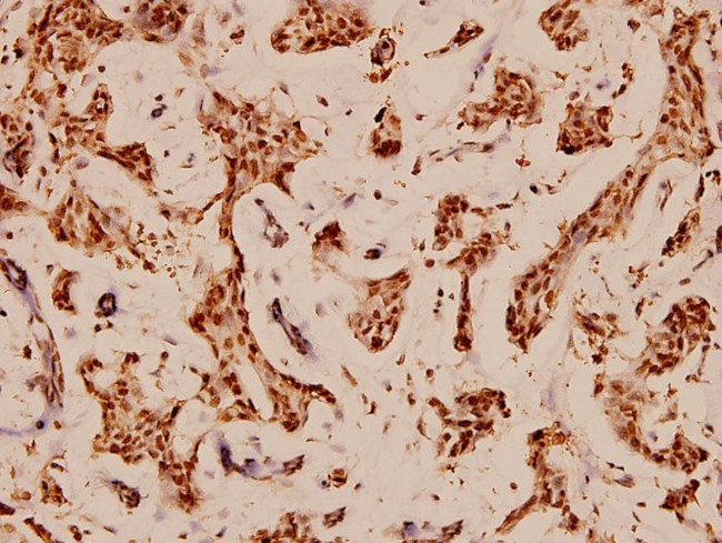 Bcl-X Antibody in Immunohistochemistry (Paraffin) (IHC (P))