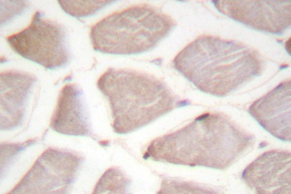 CHOP Antibody in Immunohistochemistry (Paraffin) (IHC (P))