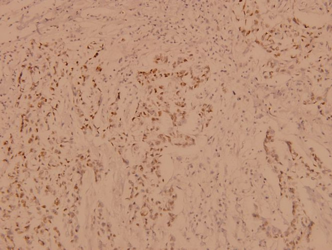 PBK Antibody in Immunohistochemistry (Paraffin) (IHC (P))