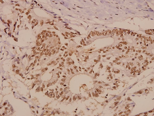 PTP1B Antibody in Immunohistochemistry (Paraffin) (IHC (P))