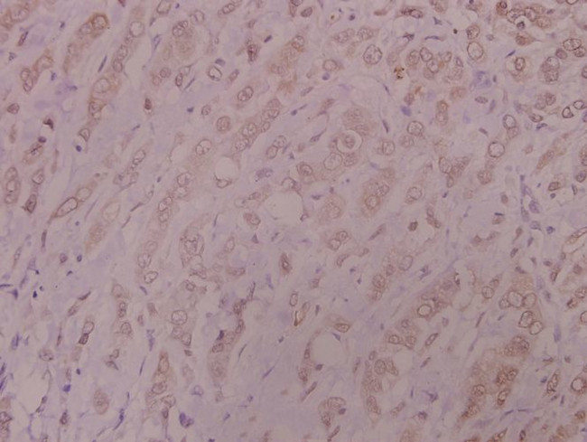 DNA-PK Antibody in Immunohistochemistry (Paraffin) (IHC (P))