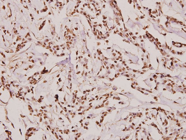 Fibronectin Antibody in Immunohistochemistry (Paraffin) (IHC (P))