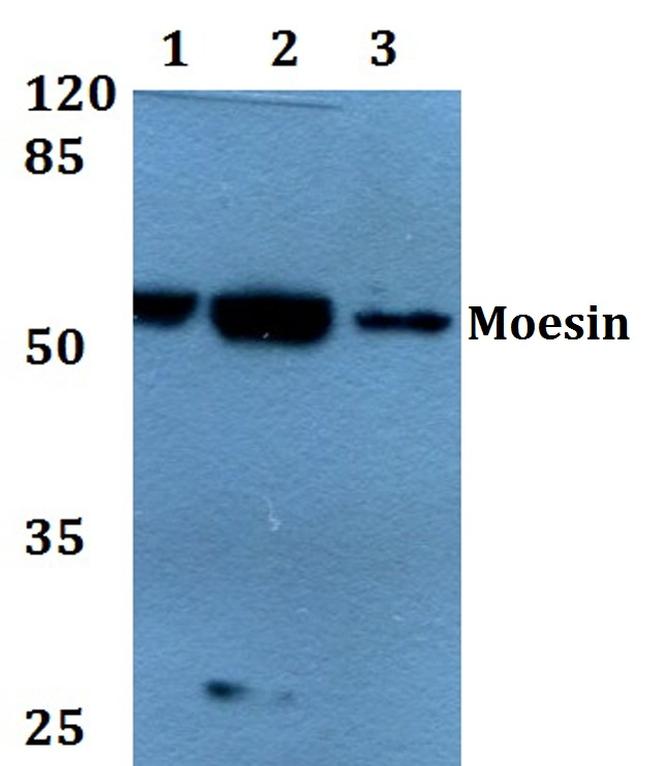 Moesin Antibody in Western Blot (WB)