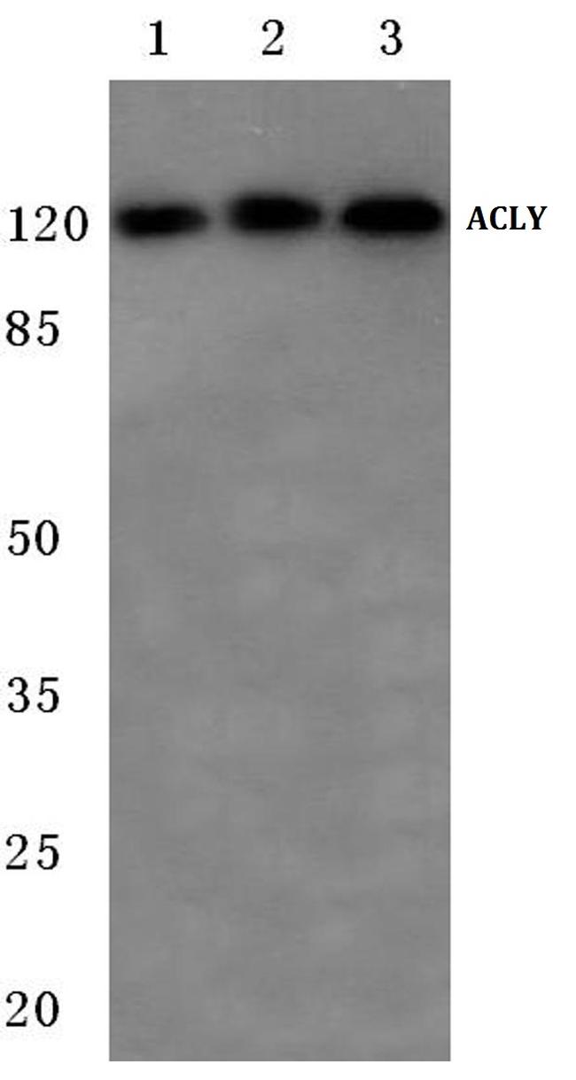 ATP Citrate Lyase Antibody in Western Blot (WB)