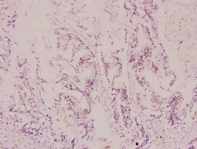 Aconitase 1 Antibody in Immunohistochemistry (Paraffin) (IHC (P))