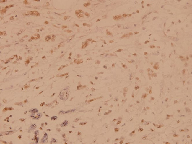 SSB Antibody in Immunohistochemistry (Paraffin) (IHC (P))