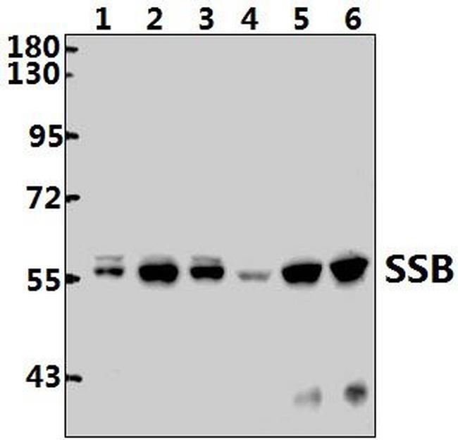 SSB Antibody in Western Blot (WB)