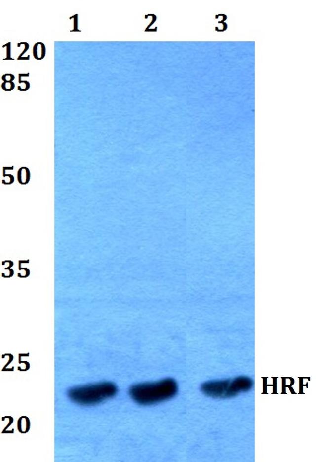 TPT1 Antibody in Western Blot (WB)