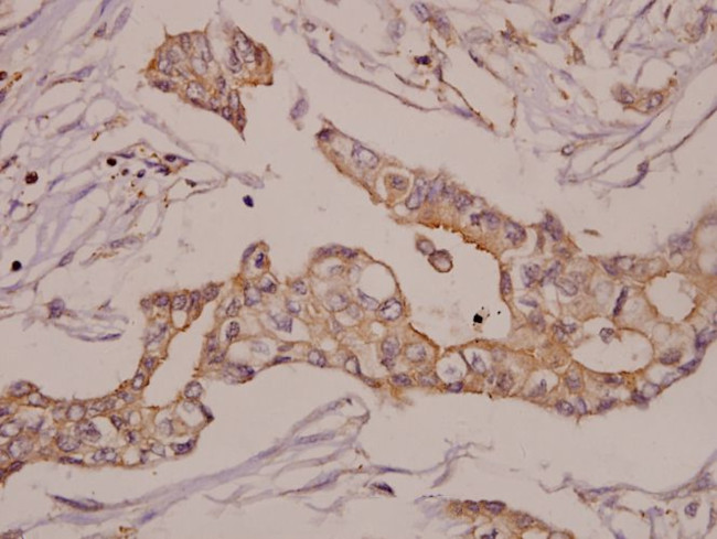 GRK2 Antibody in Immunohistochemistry (Paraffin) (IHC (P))