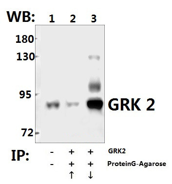 GRK2 Antibody in Immunoprecipitation (IP)