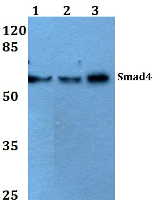 SMAD4 Antibody in Western Blot (WB)