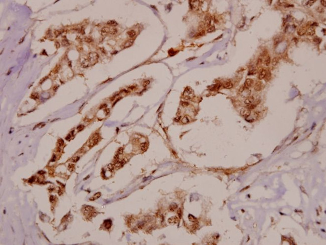 BRD3 Antibody in Immunohistochemistry (Paraffin) (IHC (P))