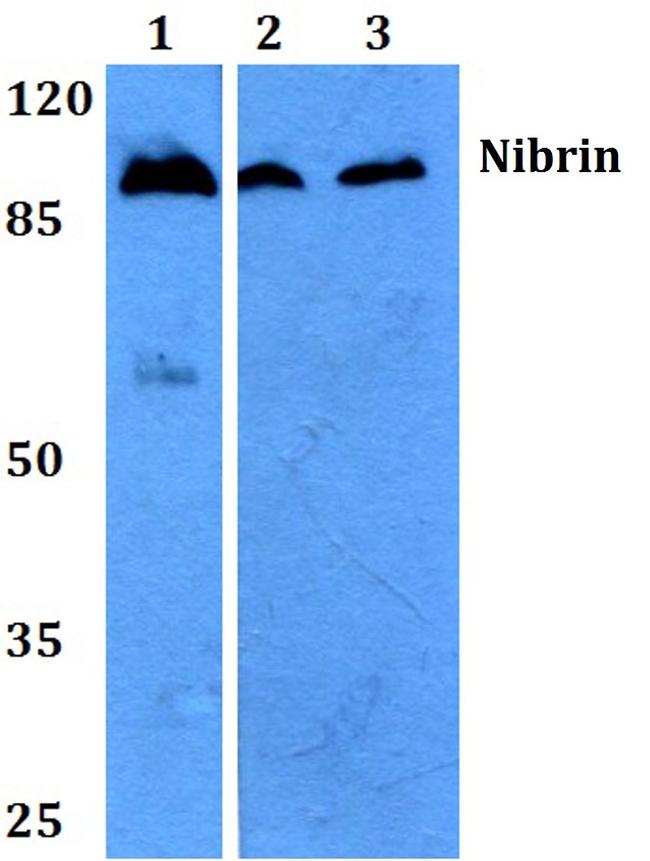 NBS1 Antibody in Western Blot (WB)