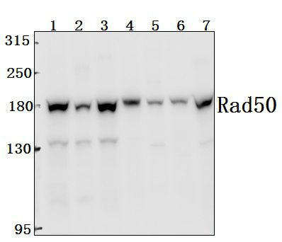 RAD50 Antibody in Immunohistochemistry (Paraffin) (IHC (P))