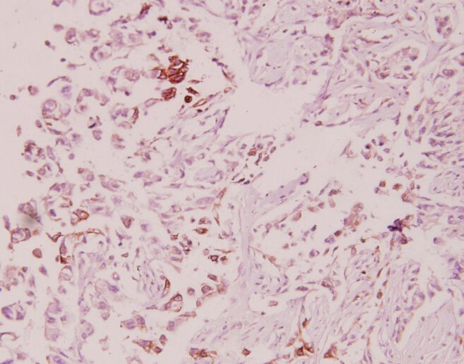 ILKAP Antibody in Immunohistochemistry (Paraffin) (IHC (P))