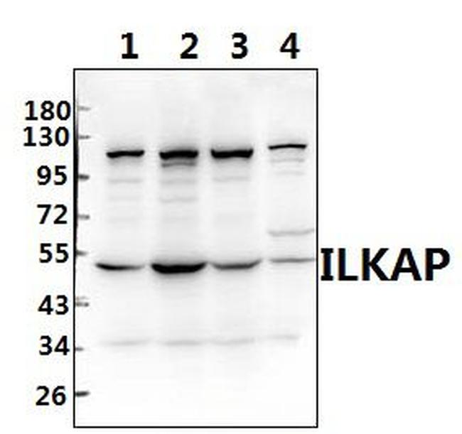 ILKAP Antibody in Western Blot (WB)
