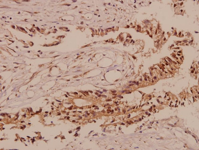 TCF3 Antibody in Immunohistochemistry (Paraffin) (IHC (P))