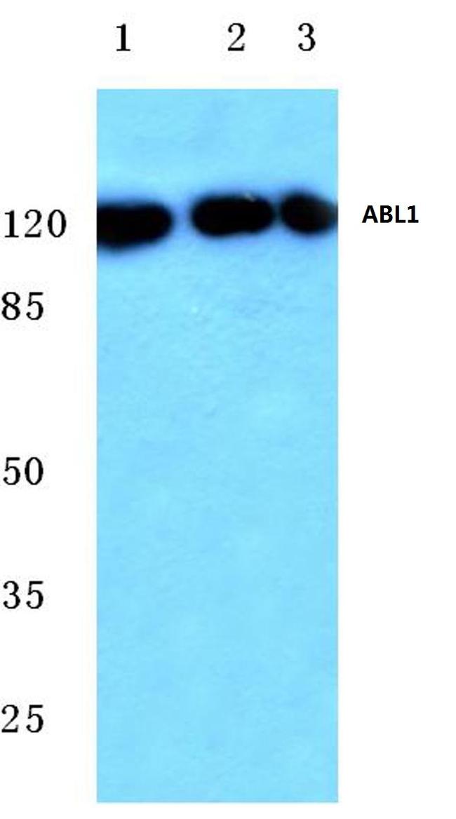 c-Abl Antibody in Western Blot (WB)