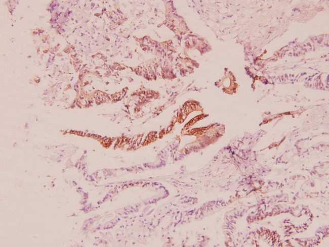 PIK3R2 Antibody in Immunohistochemistry (Paraffin) (IHC (P))