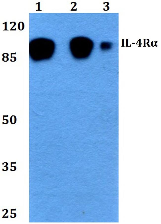 IL4R Antibody in Western Blot (WB)