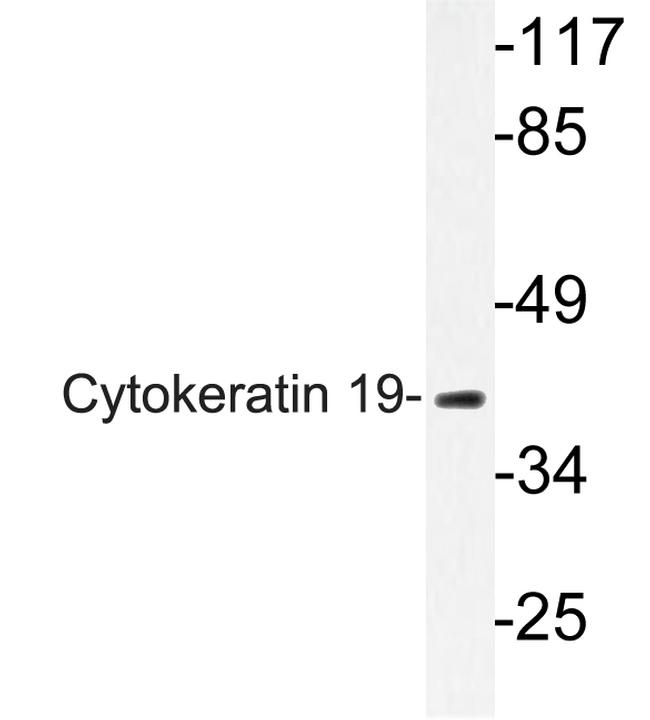 Cytokeratin 19 Antibody in Western Blot (WB)