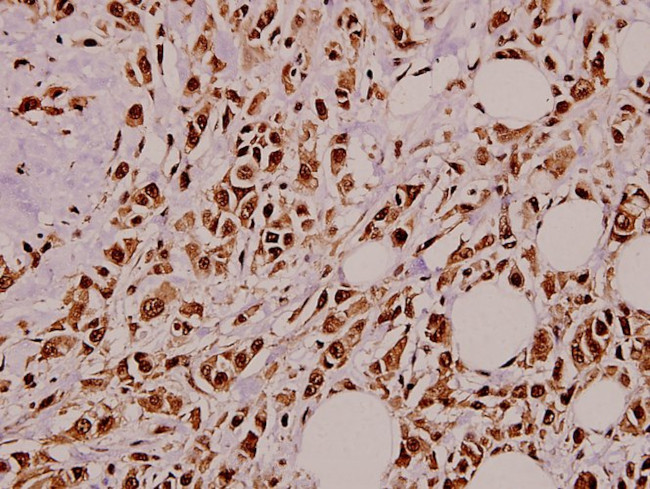 NGF Antibody in Immunohistochemistry (Paraffin) (IHC (P))