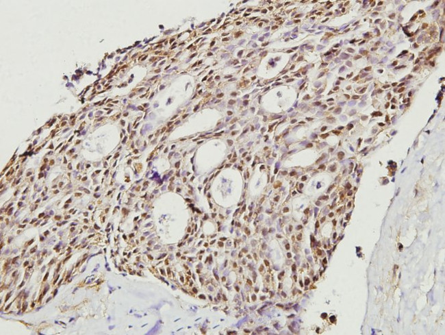 Cofilin Antibody in Immunohistochemistry (Paraffin) (IHC (P))