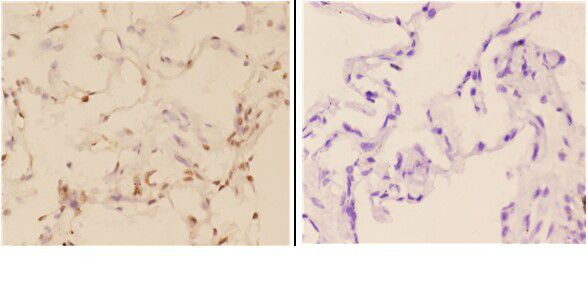 c-Abl Antibody in Immunohistochemistry (Paraffin) (IHC (P))