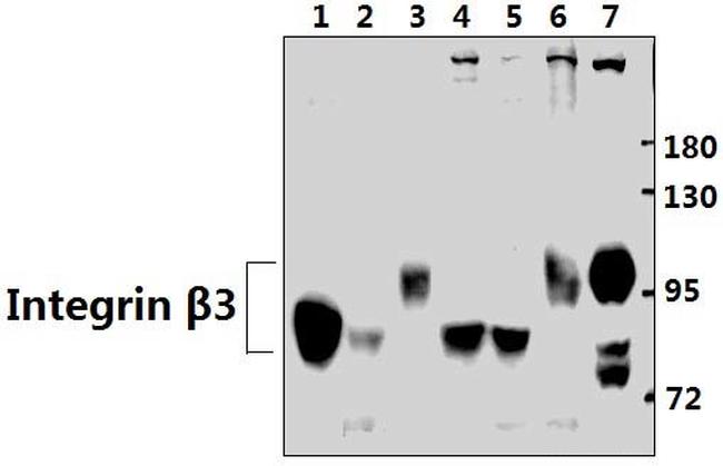CD61 Antibody in Western Blot (WB)
