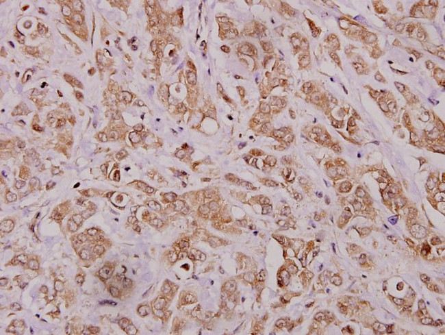 MMP12 Antibody in Immunohistochemistry (Paraffin) (IHC (P))