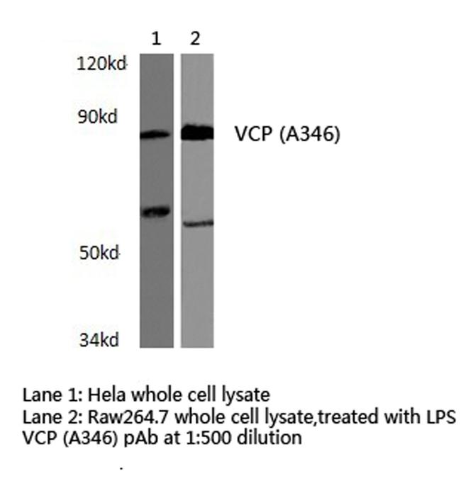 Vcp Polyclonal Antibody Pa5 86653