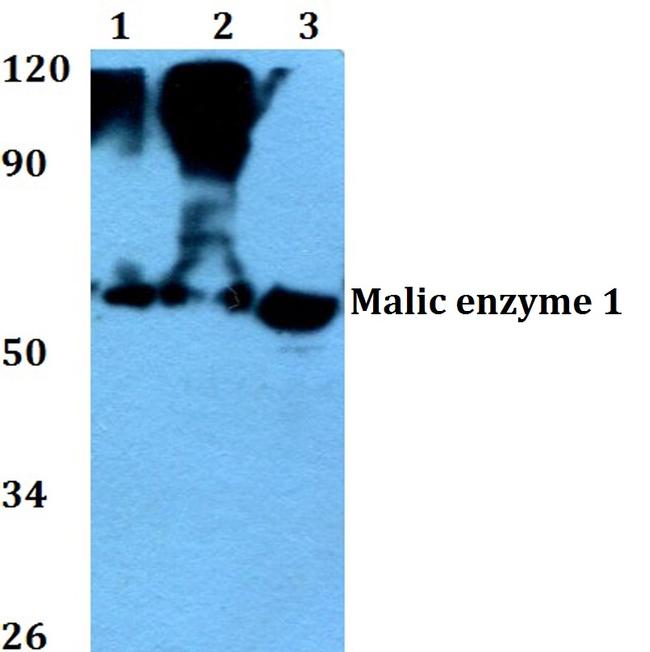 ME1 Antibody in Western Blot (WB)