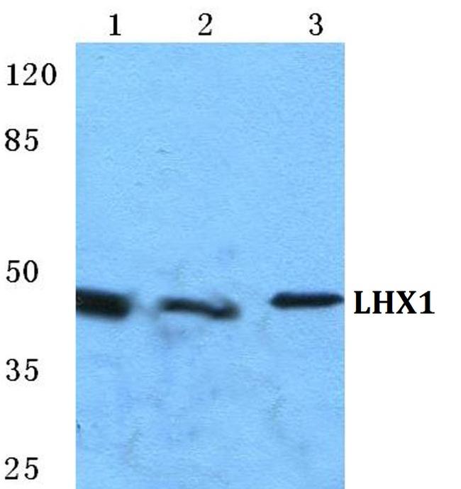 LIM1 Antibody in Western Blot (WB)