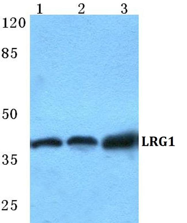 LRG1 Antibody in Western Blot (WB)