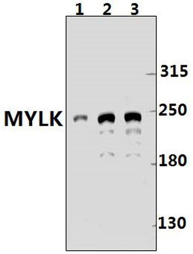 MYLK Antibody in Western Blot (WB)