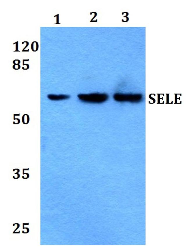 E-selectin Antibody in Western Blot (WB)