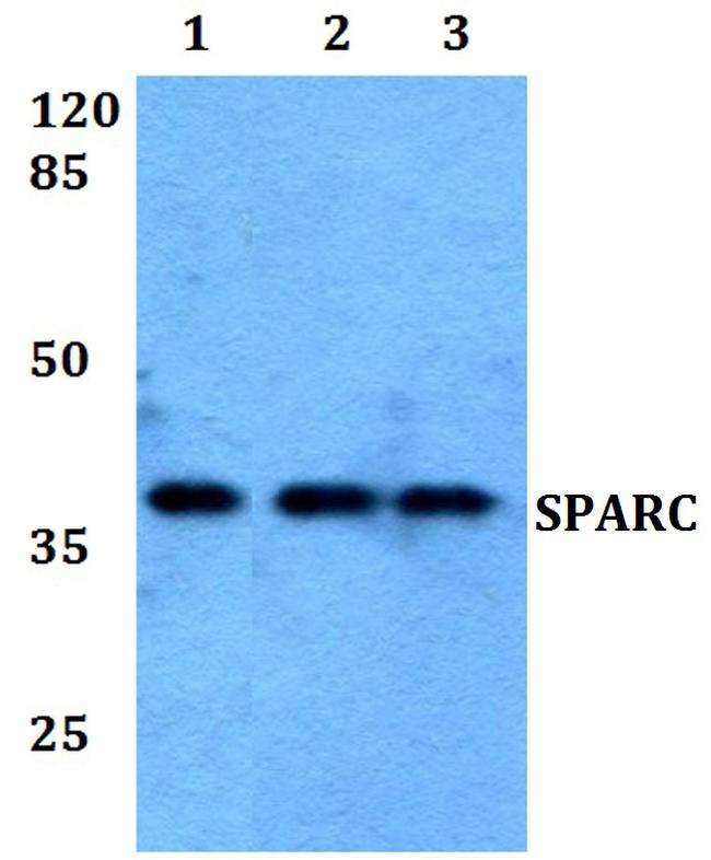 SPARC Antibody in Western Blot (WB)