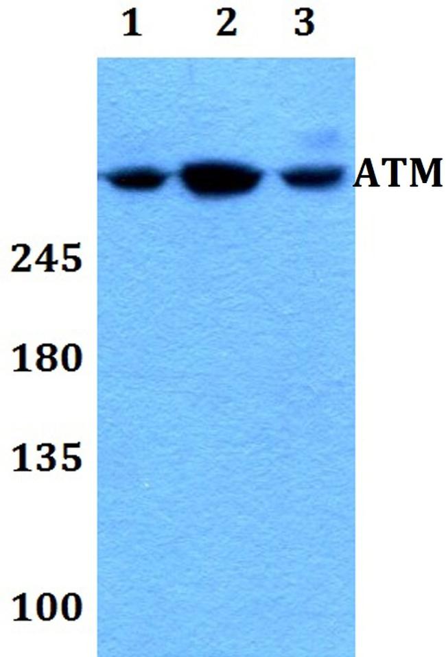 ATM Antibody in Western Blot (WB)