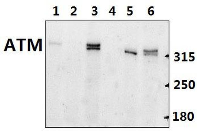 ATM Antibody in Western Blot (WB)