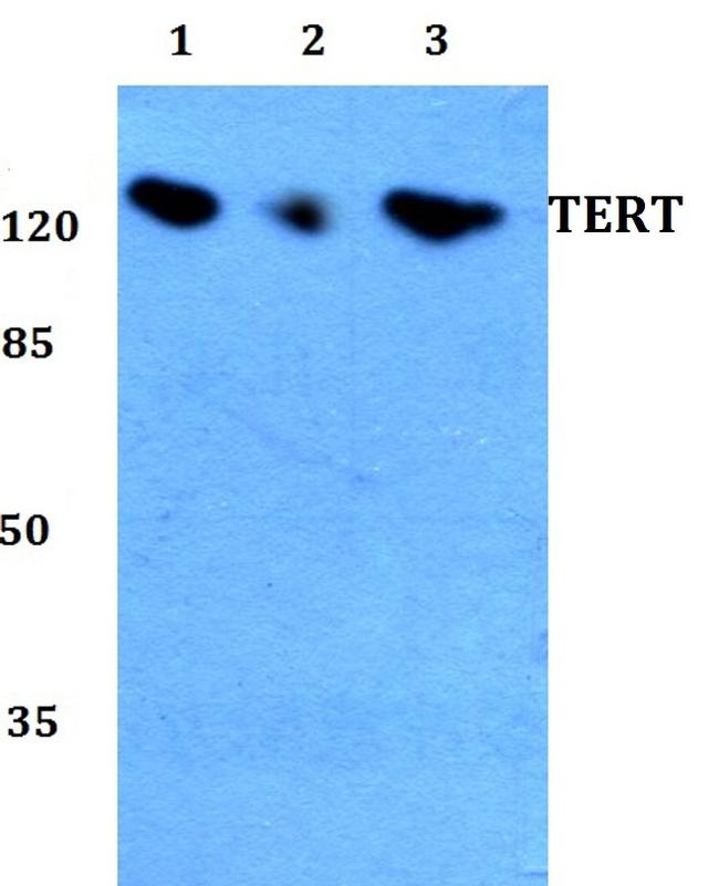 TERT Antibody in Western Blot (WB)