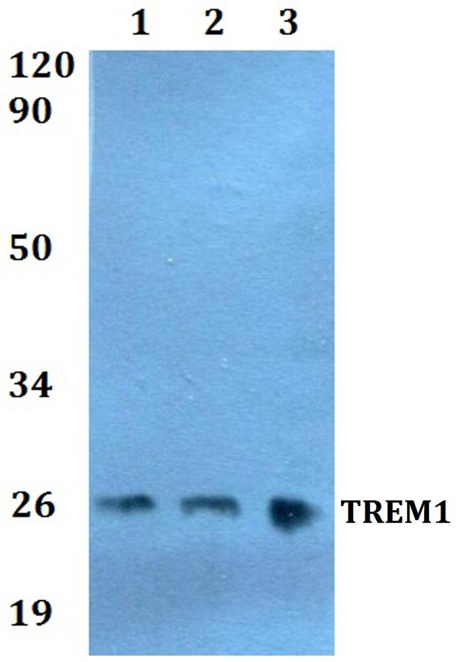 TREM1 Antibody in Western Blot (WB)