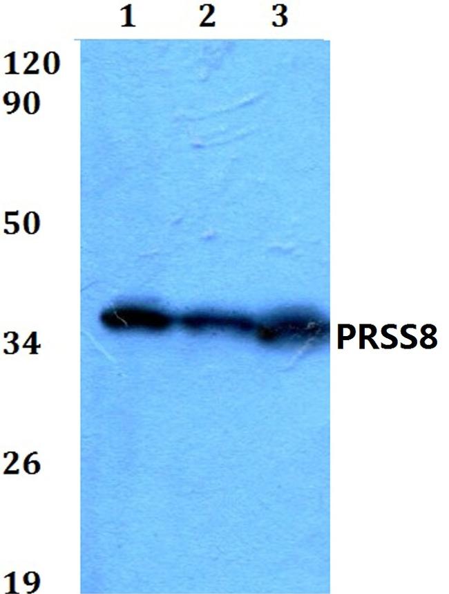 Prostasin Antibody in Western Blot (WB)