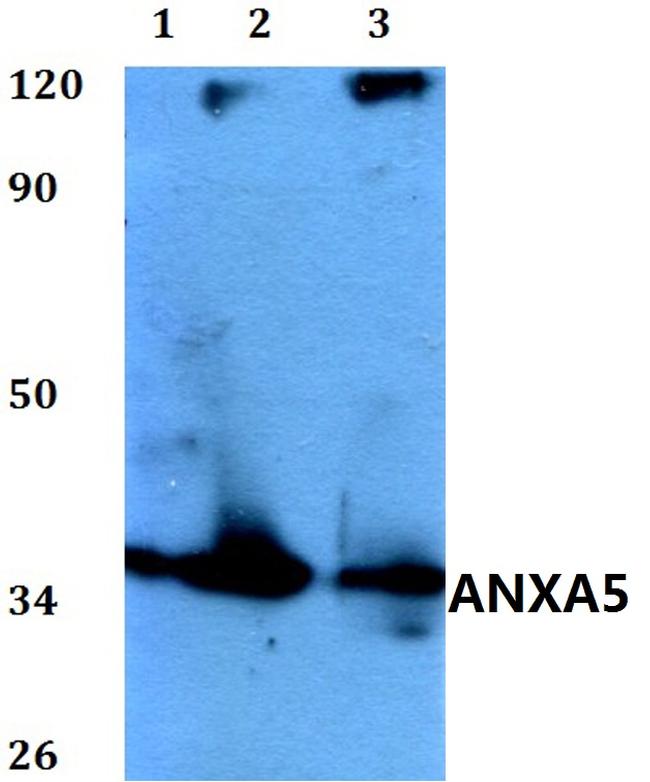 Annexin V Antibody in Western Blot (WB)