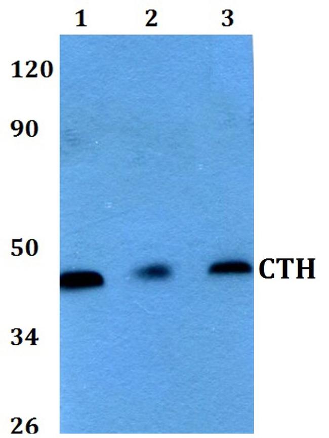 CTH Antibody in Western Blot (WB)