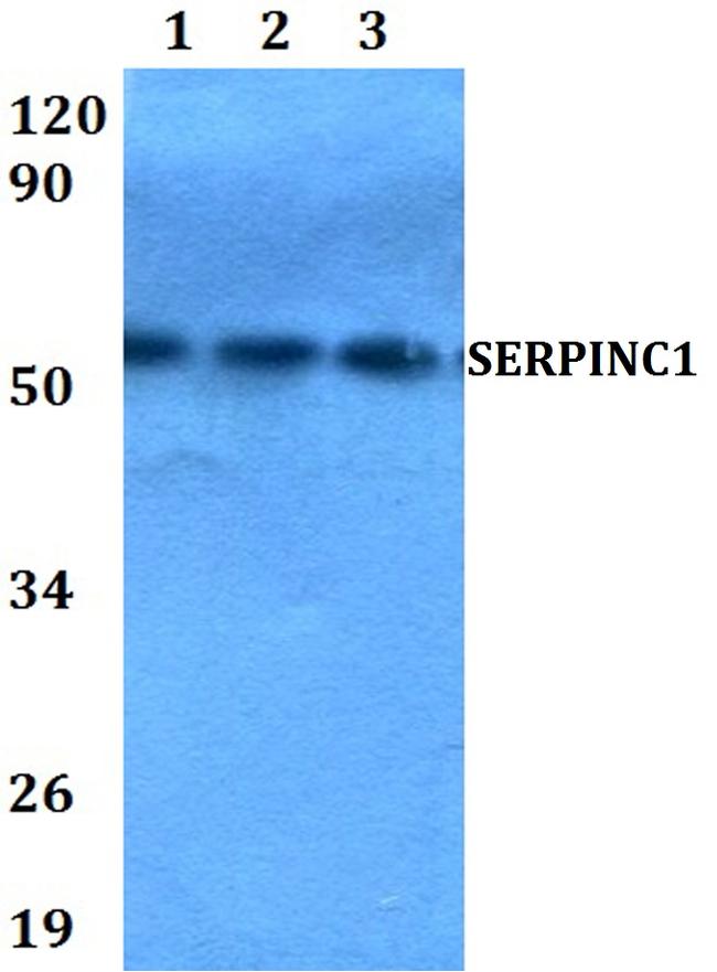 SERPINC1 Antibody in Western Blot (WB)